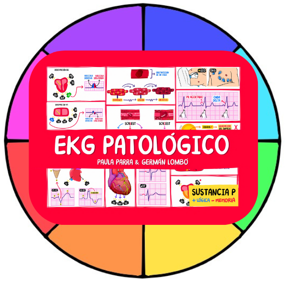 EKG-PATOLOGICO-